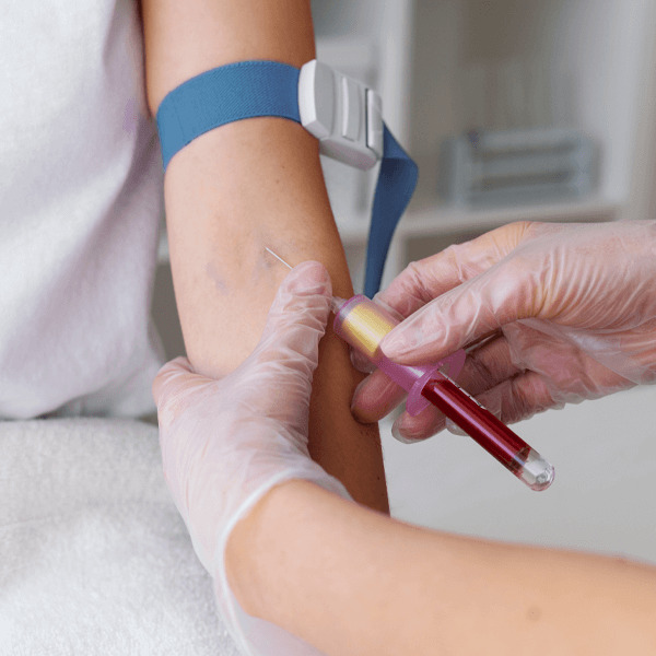 Taller de Extracción de Sangre