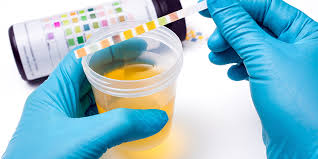 Curso Básico Teórico Práctico de Uroanálisis