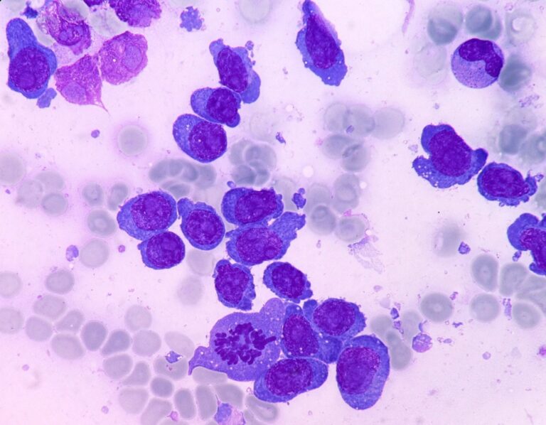 Curso de “Citomorfología: Sangre Periférica y Médula Ósea”